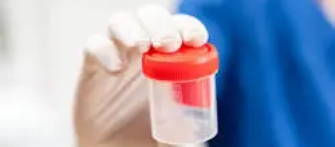 Lab technician holding a 5-panel drug test cup at a DOT testing facility